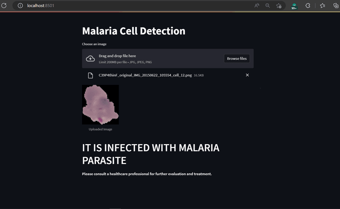 Malaria Cell Detection CNN